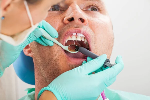 歯科医のドリルを用いた歯科治療 男性の患者さんの口腔内の写真を閉じる — ストック写真