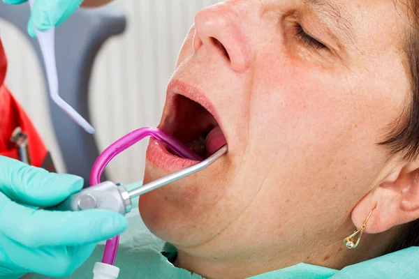 Femme Âgée Dans Chaise Dentiste Avec Bouche Ouverte Durring Traitement — Photo