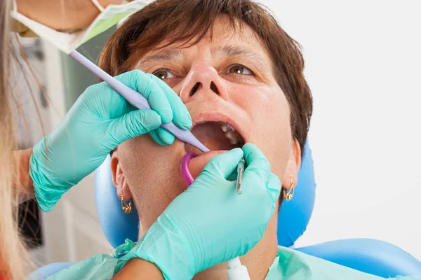 Femme Âgée Dans Chaise Dentiste Avec Bouche Ouverte Durring Traitement — Photo