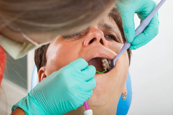 Femme Âgée Dans Chaise Dentiste Avec Bouche Ouverte Durring Traitement — Photo