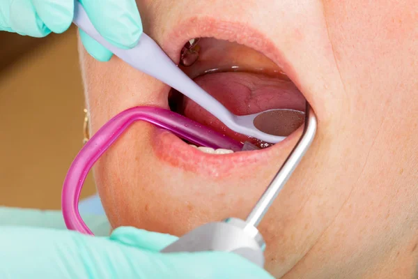 资深妇女在牙医椅子与嘴开放 Durring 牙科治疗 — 图库照片