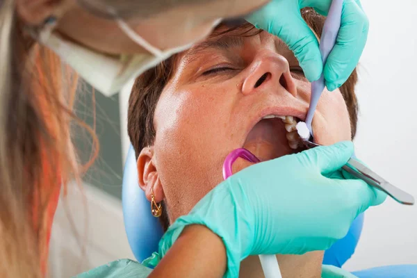 Donna Anziana Sulla Sedia Del Dentista Con Bocca Aperta Durante — Foto Stock