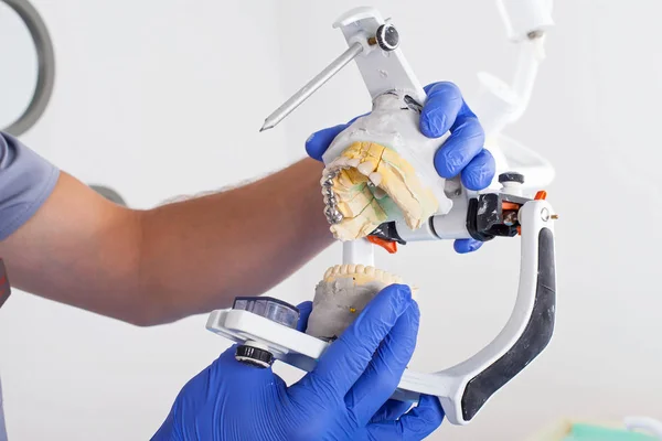 Dentista Usando Articulador Dental Para Uma Oclusão Correta — Fotografia de Stock