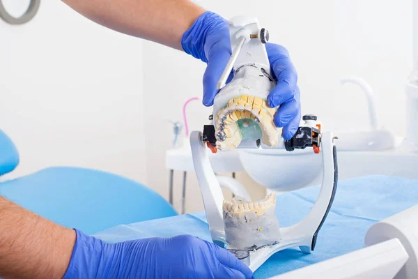 Dentista Usando Articulador Dental Para Uma Oclusão Correta — Fotografia de Stock