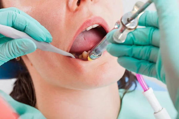 Foto Ravvicinata Della Donna Nello Studio Dentistico Che Riceve Anestesia — Foto Stock