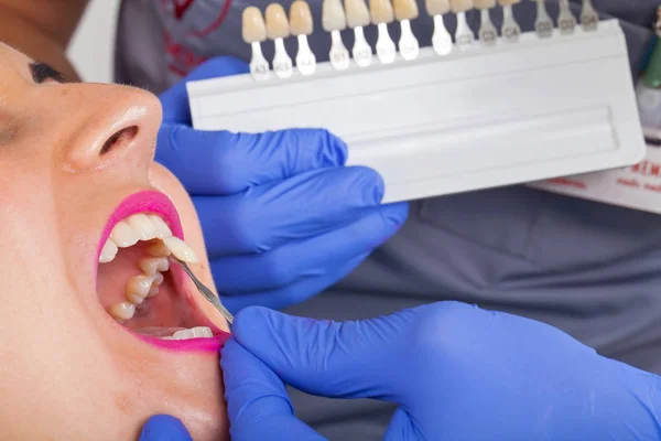 Zubní Odstín Stanovení Odstínem Průvodce Pacientka Nosí Růžové Rtěnky Zblízka — Stock fotografie