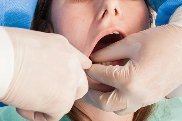 Surgeon Removing Wisdom Tooth His Assistant — Stock Photo, Image