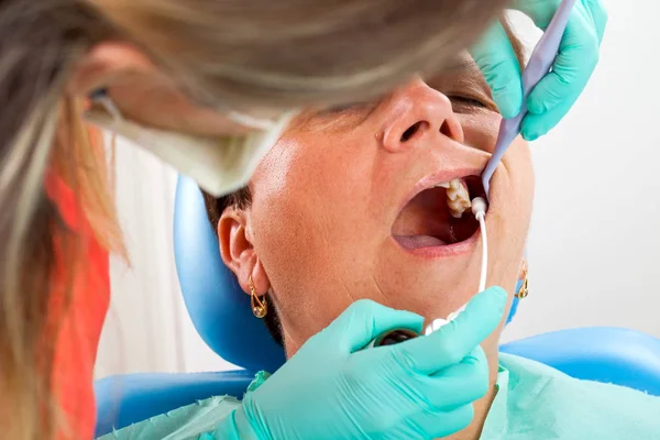 Dişçi Koltuğu Ağızlı Kadın Kıdemli Açın Durring Diş Tedavisi — Stok fotoğraf