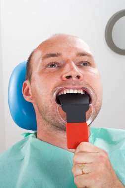 Erkek hastanın ağız boşluğu fotoğrafını çekmek dişçi resmi oluşturan kapatın