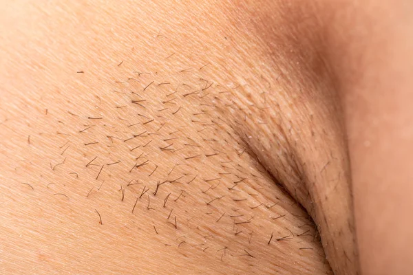 Unshaved armpit close up — Stock Photo, Image