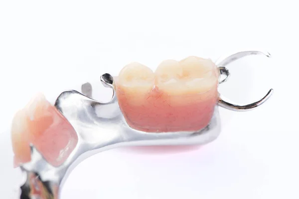 Dentiera Inferiore Metallo Con Primo Piano Sfondo Bianco — Foto Stock