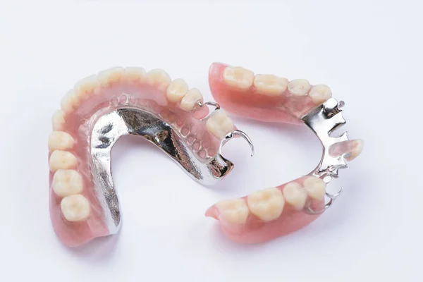 Beyaz arka plan üzerinde çıkarılabilir metal kısmi takma diş