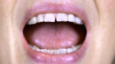 Yaşlı kadın dişlerini gösteriyor. Üst dişleri düz, alt dişleri eğri. Kadın ağzını açtı. yakın plan