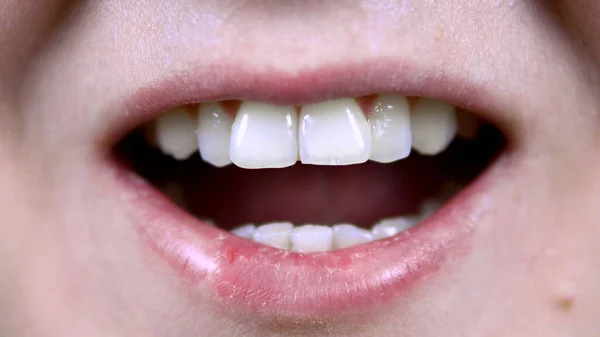 Νεαρή γυναίκα δείχνει στραβά δόντια. Η γυναίκα άνοιξε το στόμα της. Κοντινό πλάνο. — Φωτογραφία Αρχείου
