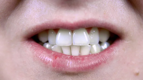 Genç kadın çarpık dişler gösteriyor. Yakın plan. — Stok fotoğraf