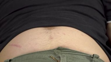 Genç bir adam kalın karnına vuruyor. Karantinada aşırı kilo almış. Karnı yakın..