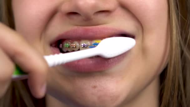 Girl with braces brush her teeth with a toothbrush closeup. A girl with colored braces on her teeth keeps her teeth clean. — Stock Video