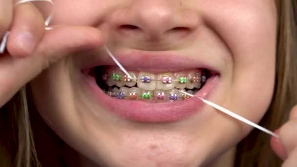 Girl with braces brushing your teeth with dental floss closeup. A girl with colored braces on her teeth keeps her teeth clean. — Stock Video