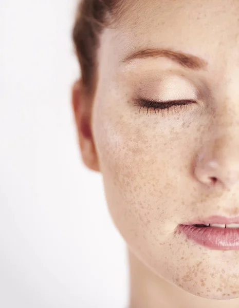 Metà Del Viso Della Donna Con Lentiggine — Foto Stock