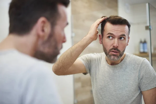 Kypsät Miehet Ovat Huolissaan Hiustenlähtöön — kuvapankkivalokuva