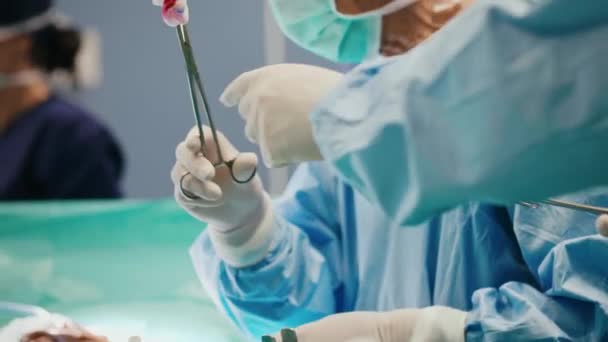忙碌的外科医生在手术中互相传递剪刀 — 图库视频影像