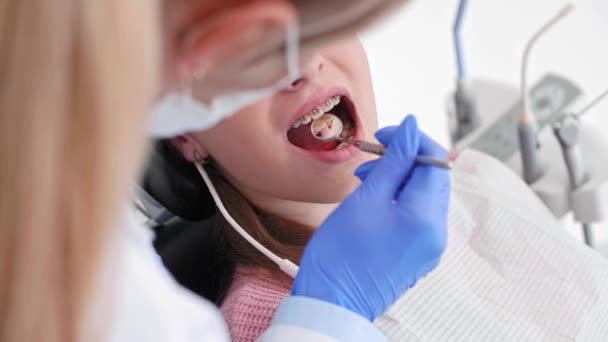 Parte Del Dentista Que Usa Espejo Dental Durante Chequeo — Vídeos de Stock