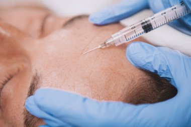 Mature man getting facial filler injections