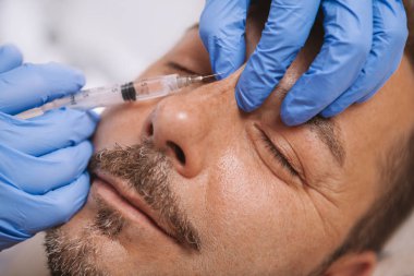 Bearded handsome mature man getting anti-wrinkle treatment 