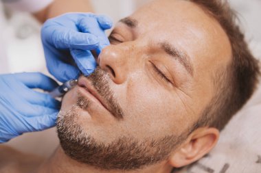 Bearded handsome mature man getting anti-wrinkle treatment 