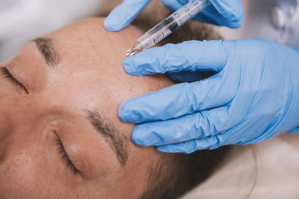 Mature man getting facial filler injections — Foto de Stock