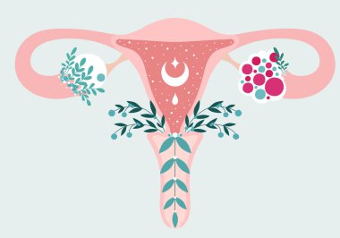 PCOS - Anatomical scheme of Uterus in flowers. Polycystic ovary syndrome - Diagram of reproductive system. Women health clipart