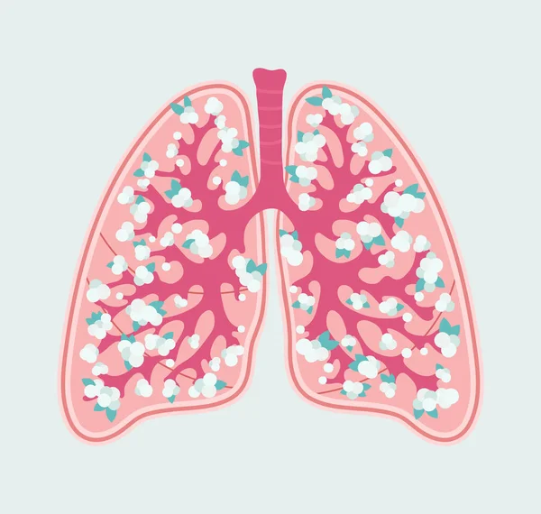 Esquema floral amigable para el paciente de pulmones humanos sanos y alvéolos. Sistema respiratorio - diagrama médico dibujado a mano — Archivo Imágenes Vectoriales