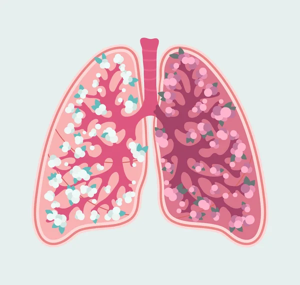 Esquema floral paciente-friendly de pulmões humanos saudáveis e alvéolos. Sistema respiratório - diagrama médico desenhado à mão — Vetor de Stock