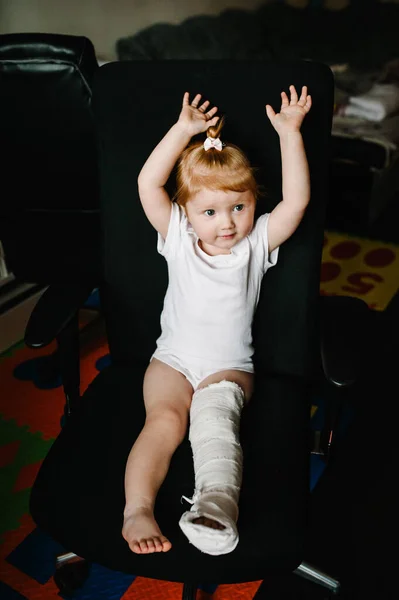 Törött Bal Láb Csont Vádli Boka Láb Vakolatban Kisgyermek Sín — Stock Fotó