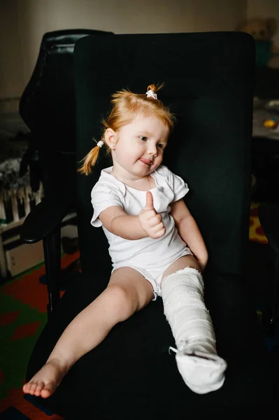 Gyermek Kötéssel Lábszárán Törött Bal Láb Csont Vádli Boka Láb — Stock Fotó