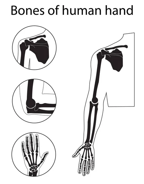 Conjunto de ilustraciones vectoriales de la anatomía esquelética de la mano humana — Vector de stock