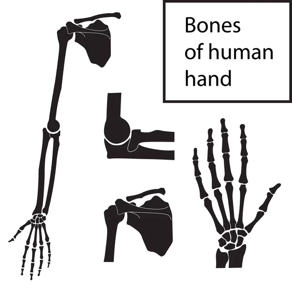 Conjunto de ilustraciones vectoriales de la anatomía esquelética de la mano humana — Vector de stock
