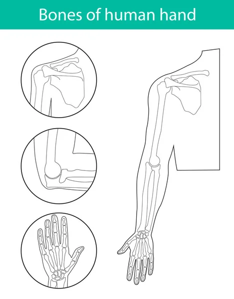 Set of vector illustrations of human hand skeletal anatomy — Stock Vector