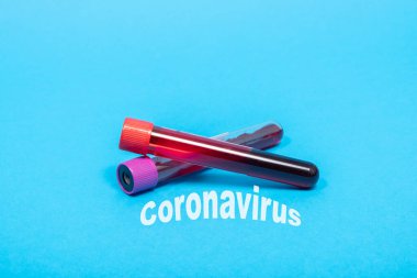 Yeni Coronavirus kan testi (2019-nCoV), mavi arka planda test tüpü koronavirüs kan testi