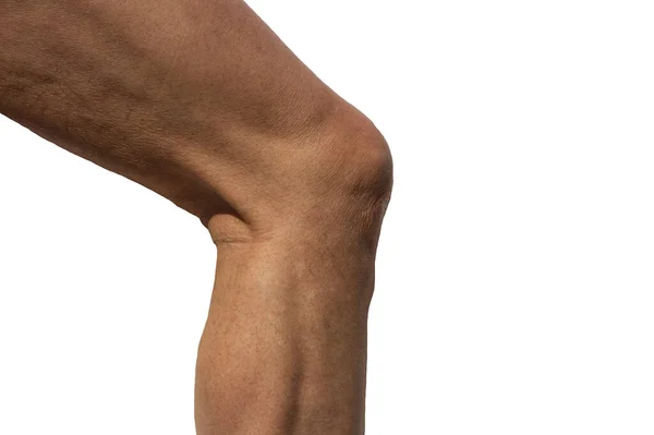 Rodilla Masculina Vista Desde Lado — Foto de Stock