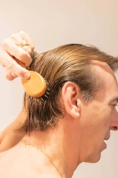 a man is having a hair loss. hair treatment.