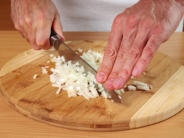 Zwiebelwürfel Füllungen Machen Zubereitung Von Fleischklößen — Stockfoto
