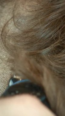 Elektrikli tıraş makinesiyle kafasını tıraş eden adamın elini kapat. Elektrikli budayıcı ile tıraş edilmiş erkek kafası. İnsan kafasını tek başına kazıtır, çok yakından. Dikey video