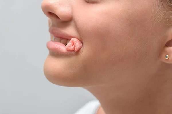 Zakrwawiony Wymaz Wystaje Ust Dziesięcioletniej Dziewczynki Wyjęciu Zęba Zbliżenie — Zdjęcie stockowe
