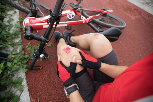 Lesiones Bicicleta Mujer Ciclista Cayó Mientras Pedaleaba Lesionó Ambas Rodillas —  Fotos de Stock