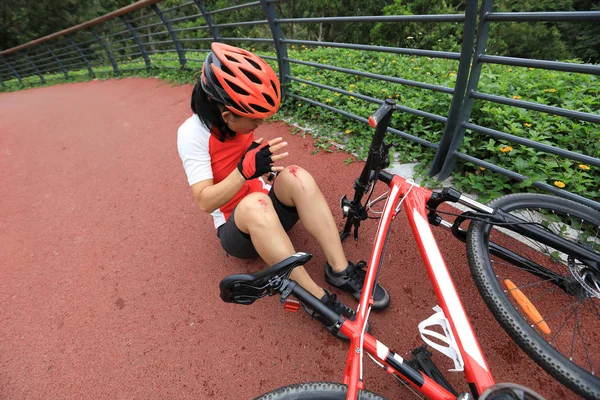 Lesiones Bicicleta Mujer Ciclista Cayó Mientras Pedaleaba Lesionó Ambas Rodillas — Foto de Stock