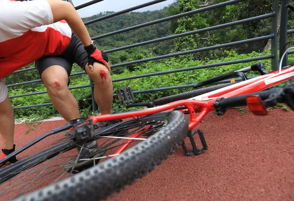 Lesiones Bicicleta Mujer Ciclista Cayó Mientras Pedaleaba Lesionó Ambas Rodillas — Foto de Stock