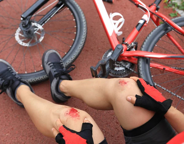 Lesiones Bicicleta Mujer Ciclista Cayó Mientras Pedaleaba Lesionó Ambas Rodillas — Foto de Stock