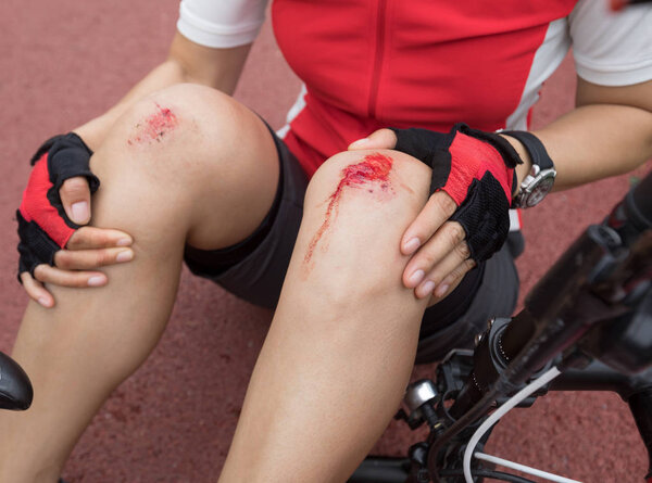 Bike injuries, woman cyclist fell down while cycling,injured both knees