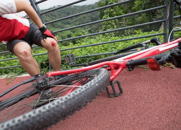Lesões Bicicleta Mulher Ciclista Caiu Durante Ciclismo Ambos Joelhos Feridos — Fotografia de Stock